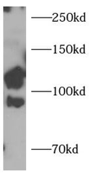 LGR5 Antibody