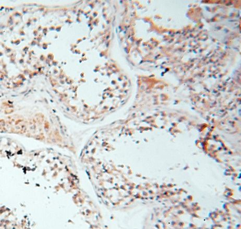 LGR6 Antibody