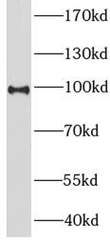 LHCGR Rabbit Polyclonal Antibody