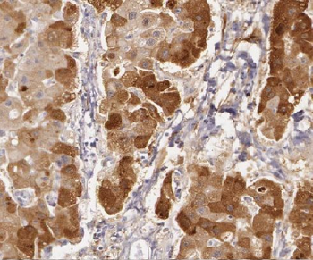 LIAS Antibody