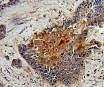 LIMS1 Antibody