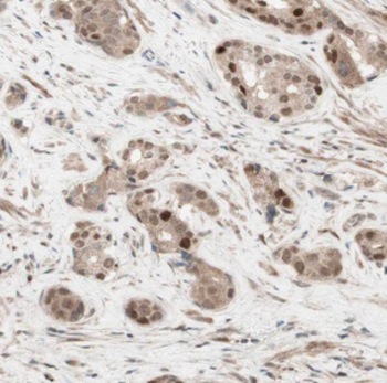 LIN28A Antibody
