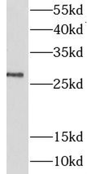 LIN28B Antibody