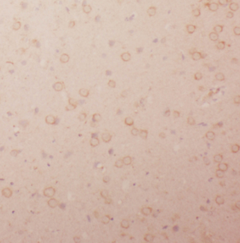 LIN7A Antibody