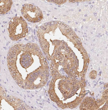 PPFIA1 Antibody