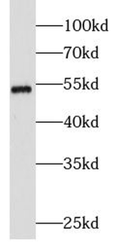 STK11 Rabbit Polyclonal Antibody