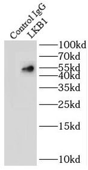 STK11 Rabbit Polyclonal Antibody