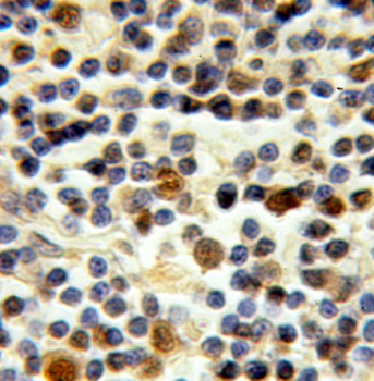 STK11 Rabbit Polyclonal Antibody