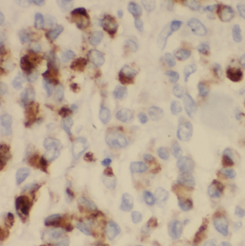 LMAN1 Antibody