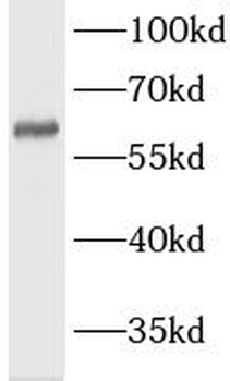 LMOD3 Antibody