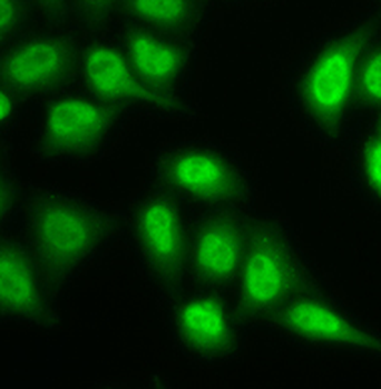 PSMB9 Antibody
