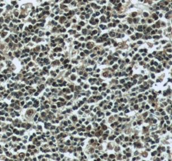 PSMB9 Antibody