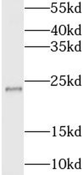 BORCS5 Rabbit Polyclonal Antibody