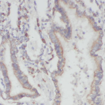 LONP1 Antibody
