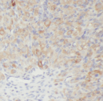 LPAR4 Antibody