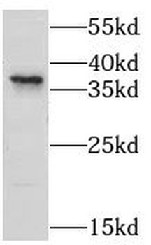 PLPPR2 Antibody