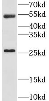 LRAT Antibody