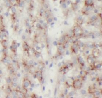 LRG1 Antibody