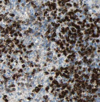 IRAG2 Antibody