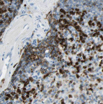 IRAG2 Antibody