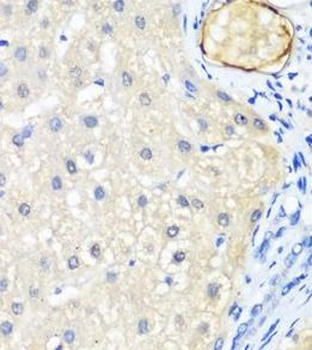 LRP5 Antibody