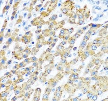 LRPPRC Rabbit Polyclonal Antibody