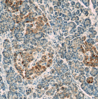 LRRC47 Antibody