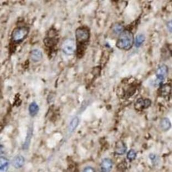 LRRC4C Antibody