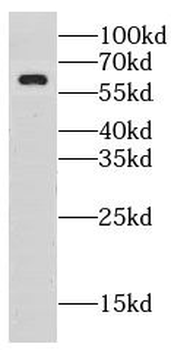 LRRTM1 Antibody