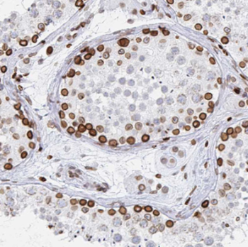 LRRTM1 Antibody