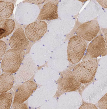 LRSAM1 Antibody
