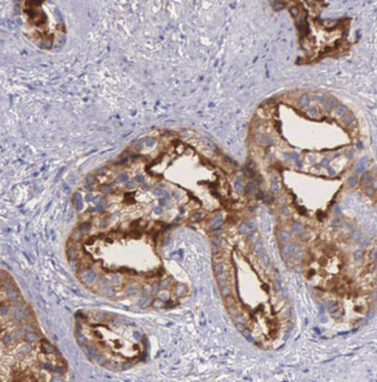 LSM1 Antibody