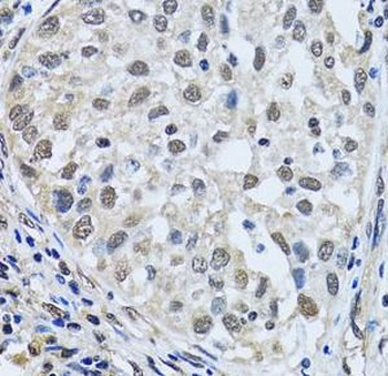 LSM4 Antibody