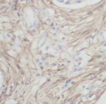 LTBP1 Antibody
