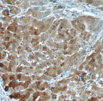 LTBR Antibody