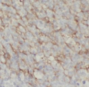 LY6D Antibody