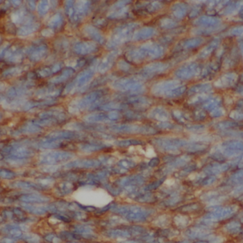 LY6E Antibody