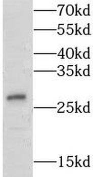 LY6K Antibody