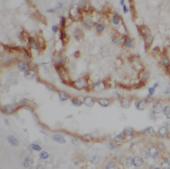 LY96 Antibody