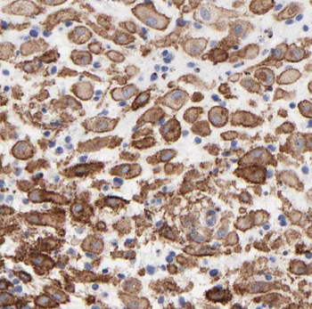LYN Mouse Monoclonal Antibody