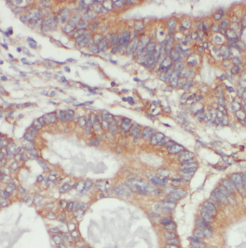 LYPLA1 Antibody