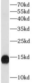 LYZ Rabbit Polyclonal Antibody