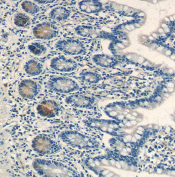 LYZ Rabbit Polyclonal Antibody