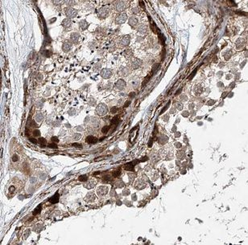 LYZL6 Rabbit Polyclonal Antibody