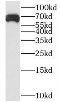 LZTS1 Antibody