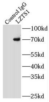 LZTS1 Antibody