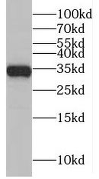 MAD2L1BP Antibody