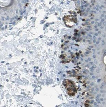 MAD2L1BP Antibody