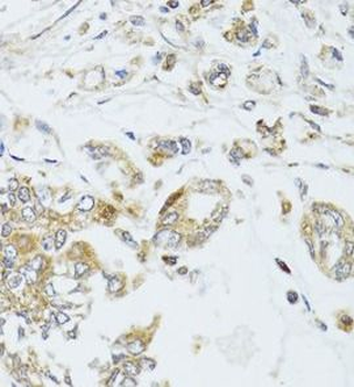 MAD2L2 Antibody
