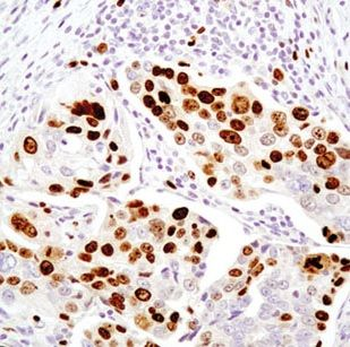 MAFF Antibody